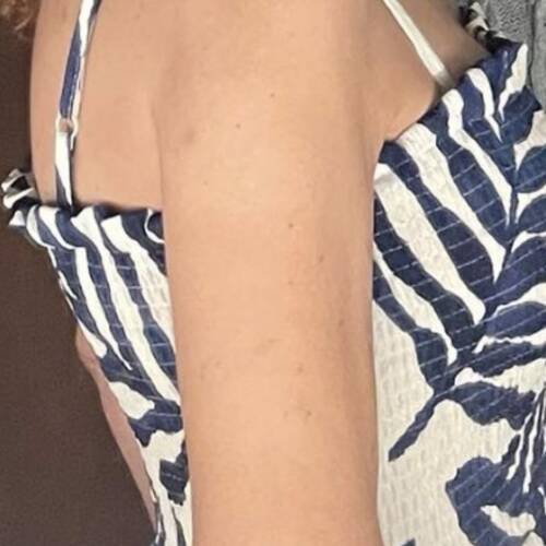 Foto extra 1