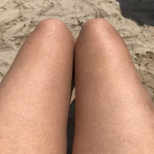 Foto extra 2