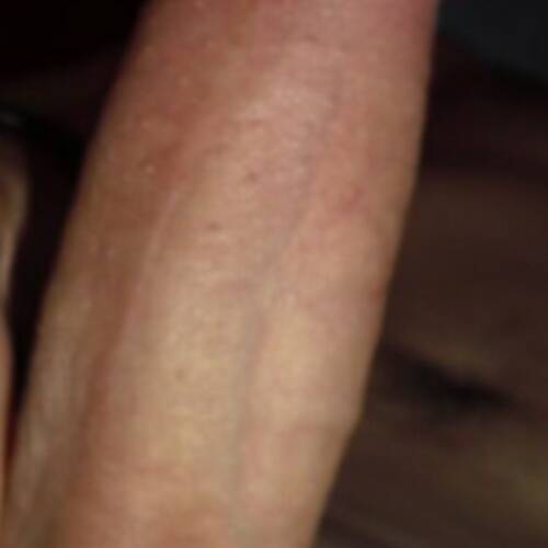 Foto extra 1